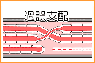 顔面神経麻痺：病的共同運動