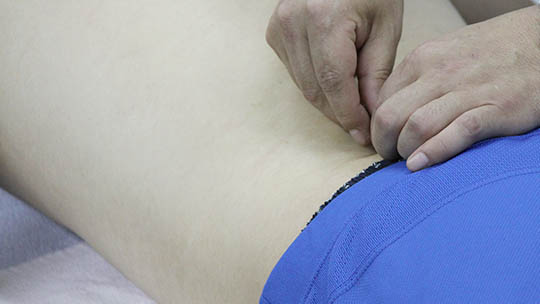 腰椎椎間板ヘルニア