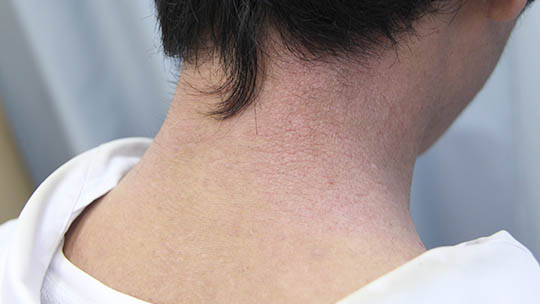 不登校・起立性調節障害