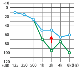 めまい・メニエール病・PPPD